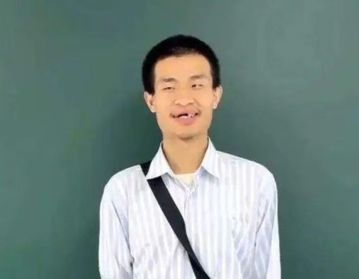 “韦神”微笑，网友心疼：牙周炎原来这么可怕！